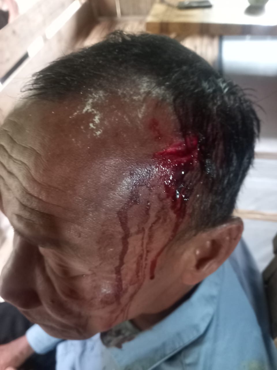 Pasca Buat Laporan Penganiayaan, Korban Minta Polsek Pangean Tangkap Pelaku